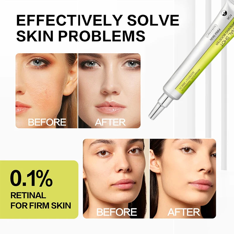 Korean Retinol Moisturizing Essence Anti-aging Lighten Dark Circles Wrinkles Eye Cream Firming Brighten Skin Vitamin C Essence