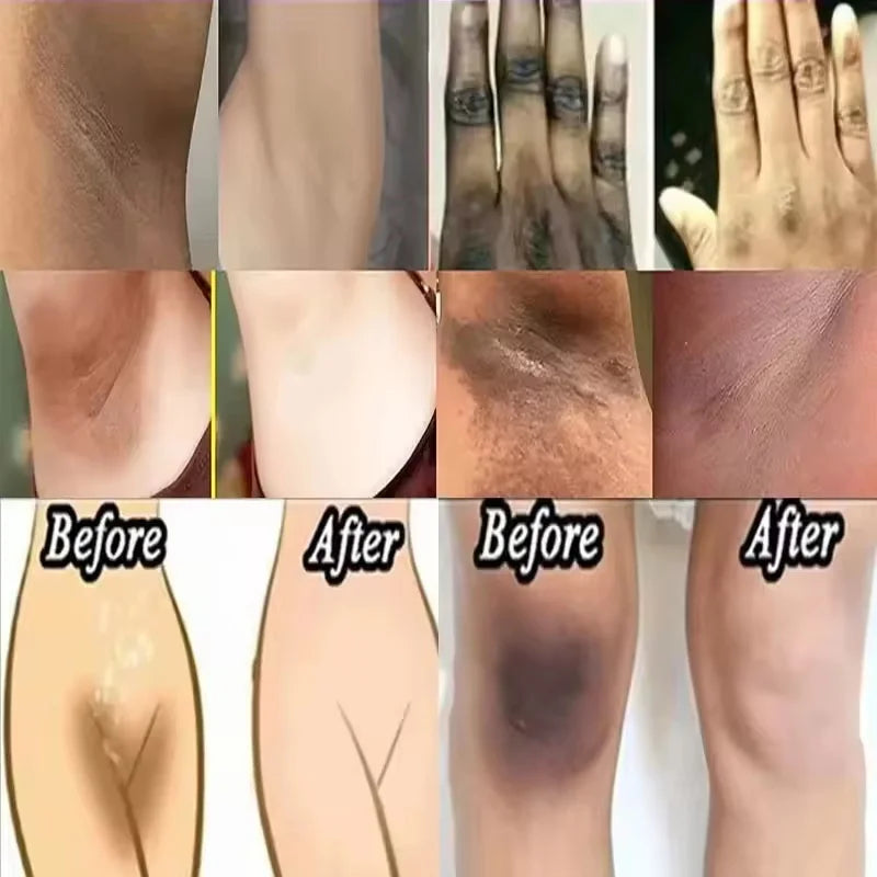 Whitening Cream For Dark Skin Underarm Bleaching Armpit Lightening And Intimate Area Woman Moisturizer Korean Skin Care Products