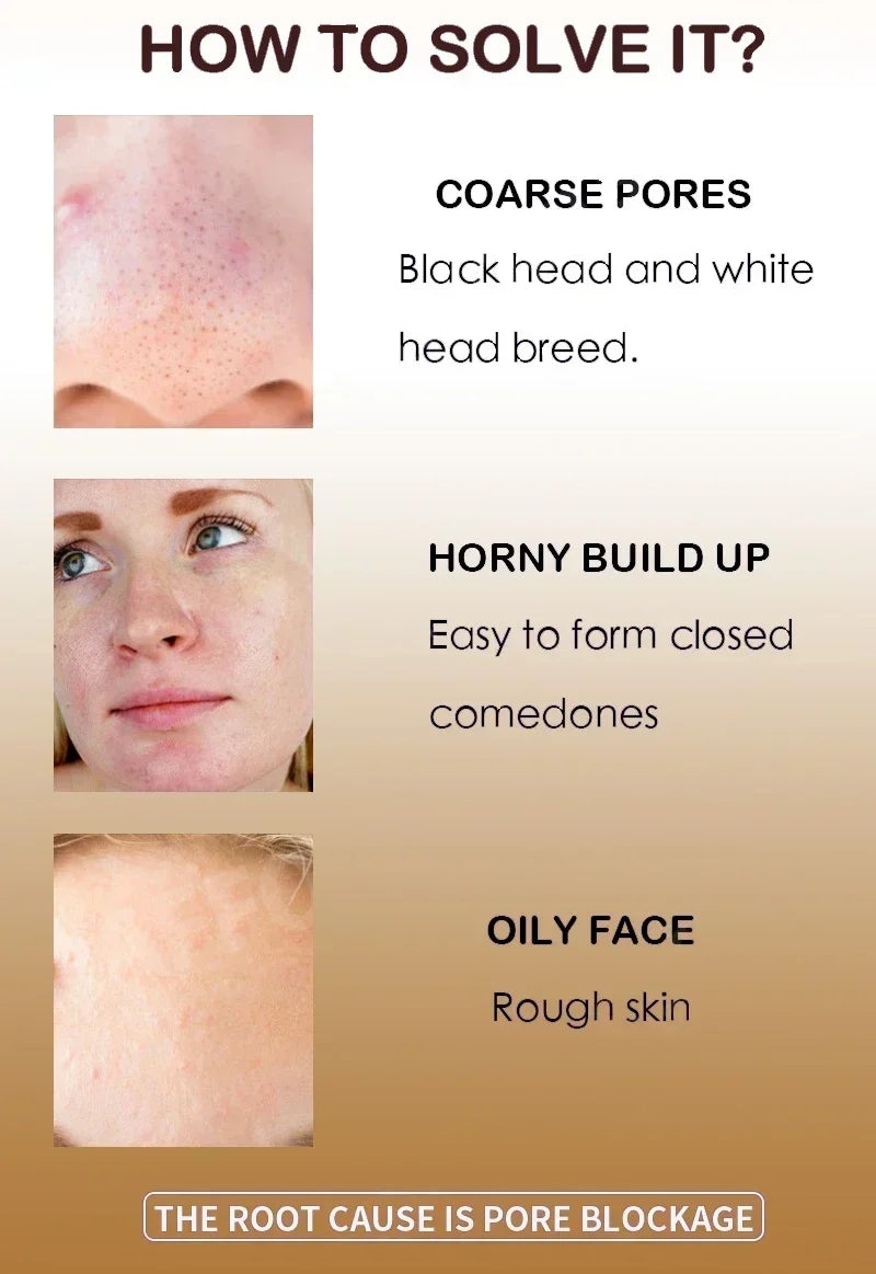 Pore Shrink Face Serum Remove Blackheads Acne Acidity Oil Control Repair Essence Moisturizing Nourish Pores Firming Facial Care