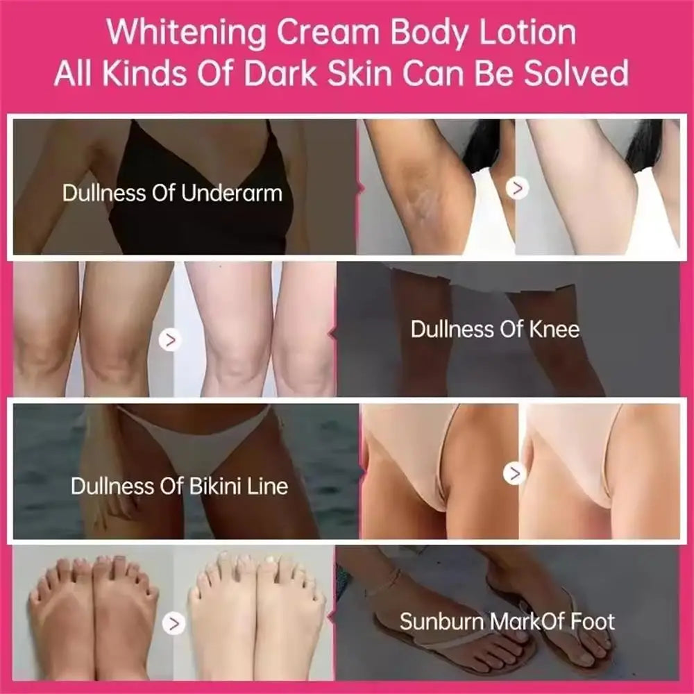 Whitening Cream For Dark Skin Underarm Bleaching Armpit Lightening And Intimate Area Woman Moisturizer Korean Skin Care Products