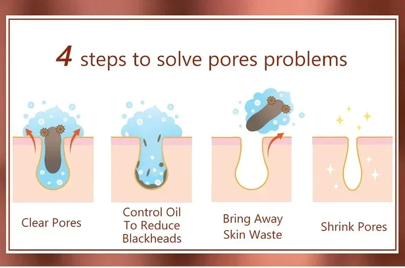 Pore Shrink Face Serum Remove Blackheads Acne Acidity Oil Control Repair Essence Moisturizing Nourish Pores Firming Facial Care