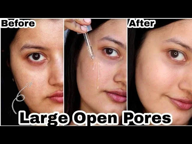 Pore Shrink Face Serum Remove Blackheads Acne Acidity Oil Control Repair Essence Moisturizing Nourish Pores Firming Facial Care