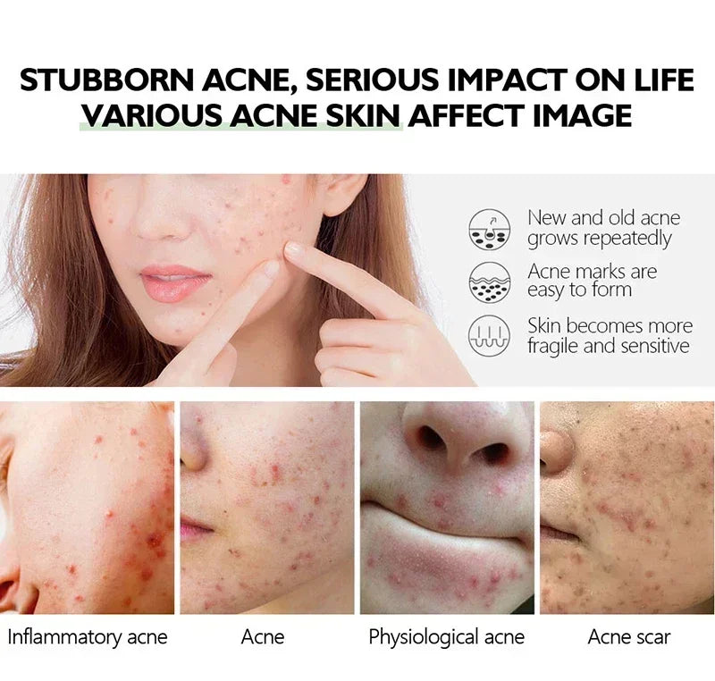 Pore Shrink Face Serum Remove Blackheads Acne Acidity Oil Control Repair Essence Moisturizing Nourish Pores Firming Facial Care