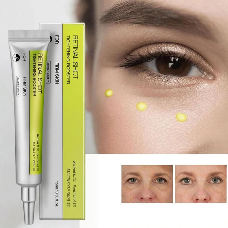 Korean Retinol Moisturizing Essence Anti-aging Lighten Dark Circles Wrinkles Eye Cream Firming Brighten Skin Vitamin C Essence