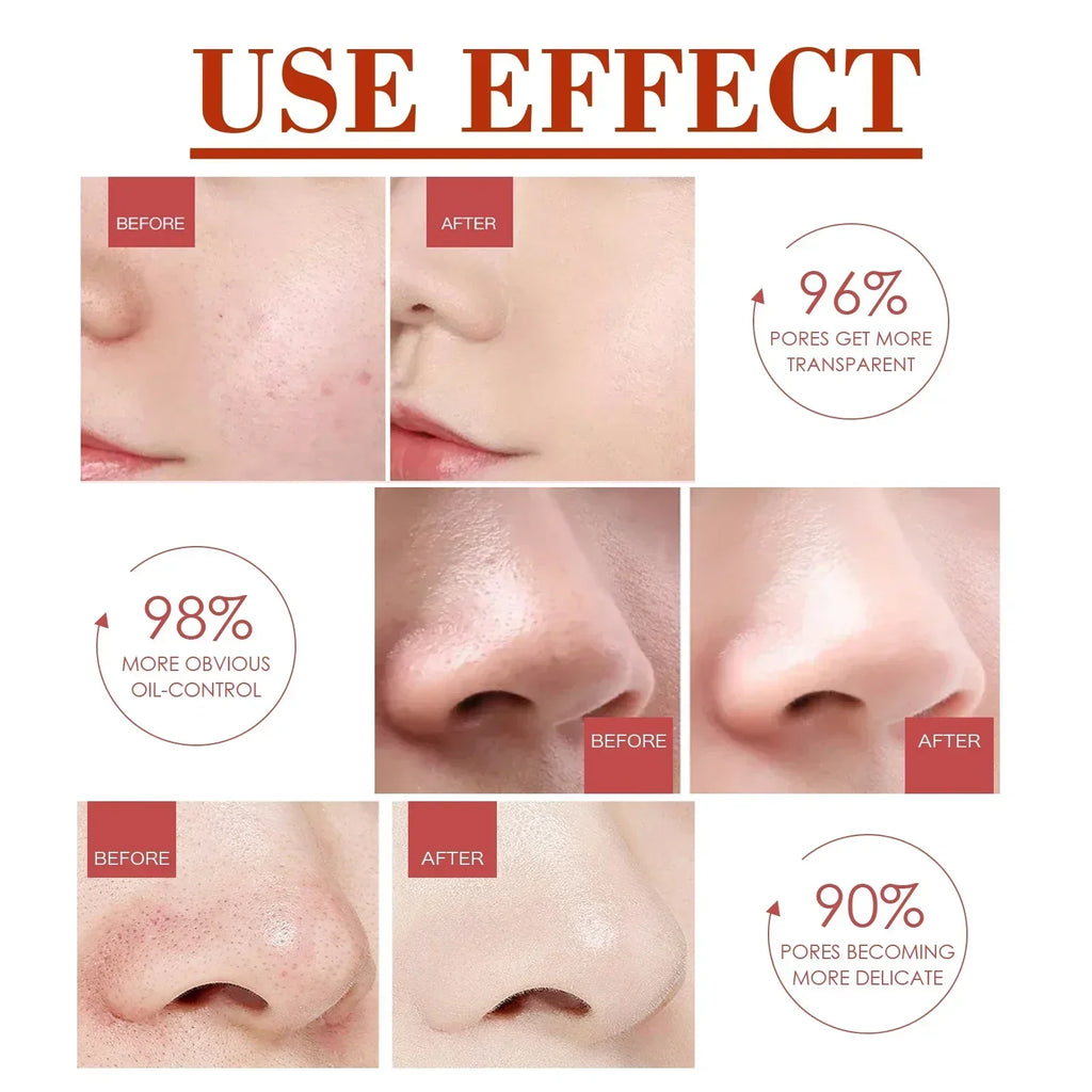 Pore Shrink Face Serum Remove Blackheads Acne Acidity Oil Control Repair Essence Moisturizing Nourish Pores Firming Facial Care