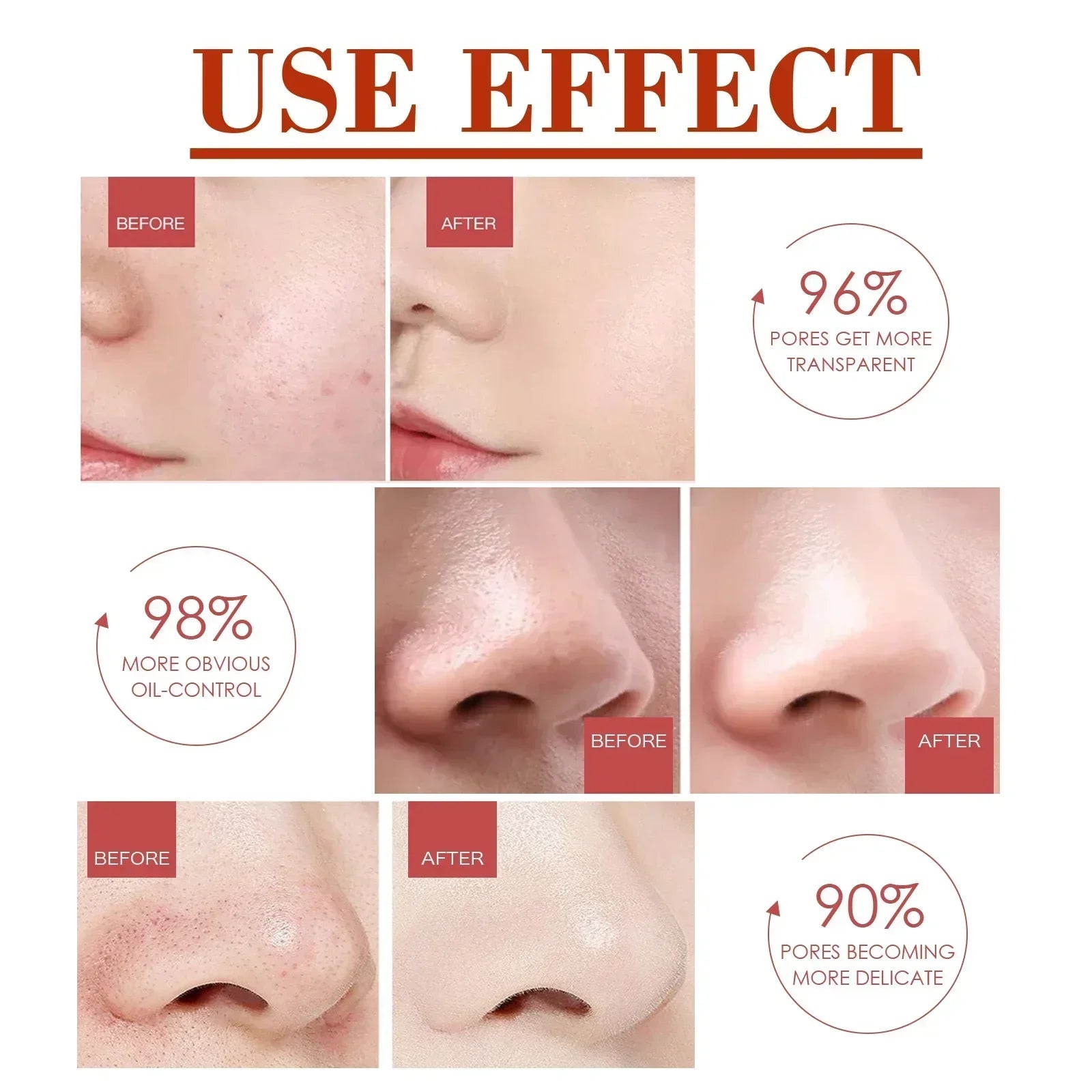 Pore Shrink Face Serum Remove Blackheads Acne Acidity Oil Control Repair Essence Moisturizing Nourish Pores Firming Facial Care